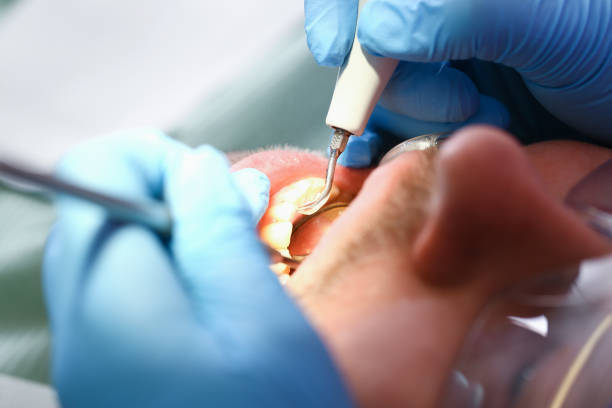 Best Dental Abscess Treatment in Fairfield, IA